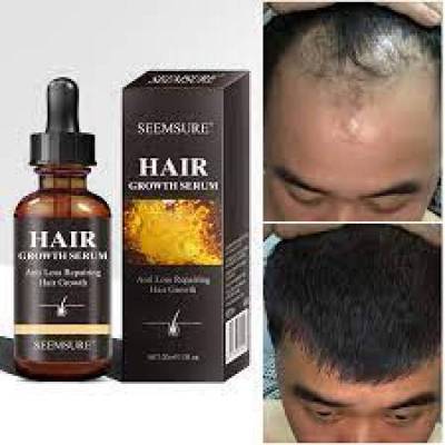 SEEMSURE® HAIR GROWTH SERUM, Anti Loss Repairing Hair Growth